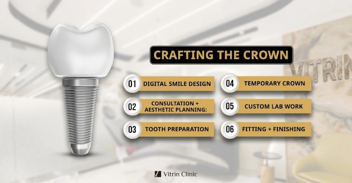The Porcelain Crown4